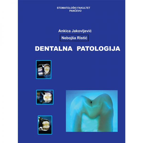 Dentalna patologija